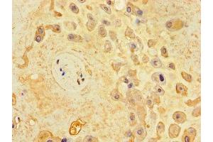 Immunohistochemistry of paraffin-embedded human placenta tissue using ABIN7166261 at dilution of 1:100 (Unc-79 Homolog (C. Elegans) (UNC79) (AA 1562-1678) antibody)