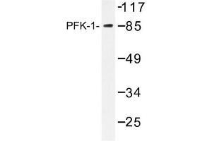 Image no. 2 for anti-Phosphofructokinase, Liver (PFKL) antibody (ABIN272176) (PFKL antibody)