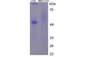 Image no. 1 for Neuromedin U (NMU) peptide (Ovalbumin) (ABIN5666294) (Neuromedin U (NMU) peptide (Ovalbumin))