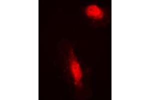 Immunofluorescent analysis of COPS3 staining in HeLa cells. (COPS3 antibody  (Center))