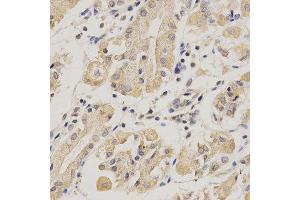 Immunohistochemistry of paraffin-embedded human stomach using SERPINF1 antibody at dilution of 1:200 (x400 lens).