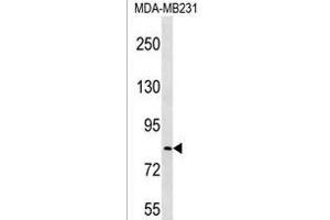 LRRC70 Antibody (C-term) (ABIN1537455 and ABIN2850345) western blot analysis in MDA-M cell line lysates (35 μg/lane).