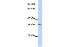 WB Suggested Anti-RHOXF2 Antibody Titration:  0. (RHOXF2 antibody  (Middle Region))