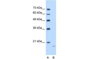 Western Blotting (WB) image for anti-Amyloid P Component, Serum (APCS) antibody (ABIN2462510) (APCS antibody)