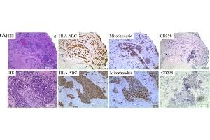 HLA-ABC identifies cells of human origin in xenografted mice. (ATPase Beta3 (Center) antibody)