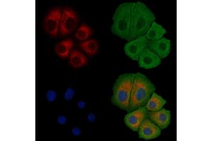 ABIN6258257 and ABIN6275216 staining Hela cells by IF/ICC. (LSP1 antibody  (C-Term))