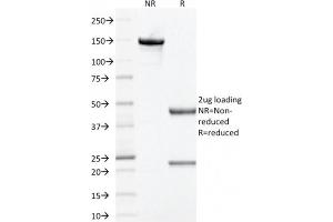 SDS-PAGE Analysis Purified Prohibitin Mouse Monoclonal Antibody (PHB/1881). (Prohibitin antibody  (AA 167-261))