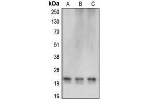 Western blot analysis of Cerebellin 4 expression in HEK293T (A), SP2/0 (B), rat liver (C) whole cell lysates. (CBLN4 antibody  (C-Term))