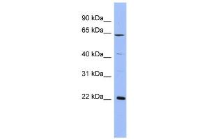 WB Suggested Anti-FREQ Antibody Titration:  0.