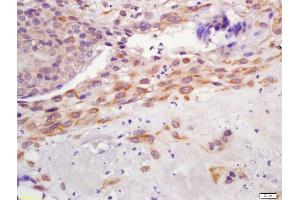 Formalin-fixed and paraffin embedded human placenta labeled with Anti-GPR126 Polyclonal Antibody, Unconjugated (ABIN1387400) at 1:200 followed by conjugation to the secondary antibody and DAB staining (G Protein-Coupled Receptor 126 antibody  (AA 741-850))