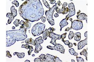 IHC analysis of NMI using anti-NMI antibody (ABIN3043451). (NMI antibody  (AA 2-307))