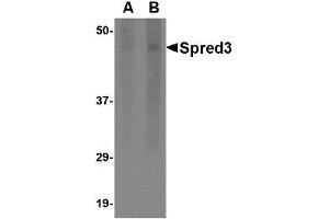 Image no. 1 for anti-Sprouty-Related, EVH1 Domain Containing 3 (SPRED3) (Internal Region) antibody (ABIN341680)