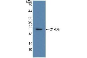 Detection of Recombinant MYL2, Human using Polyclonal Antibody to Myosin Light Chain 2 (MYL2) (MYL2 antibody  (AA 2-159))