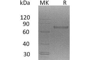 Western Blotting (WB) image for Natural Cytotoxicity Triggering Receptor 1 (NCR1) protein (His tag) (ABIN7320619)
