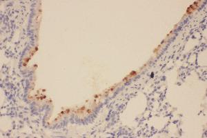 Anti-SOX2 antibody, IHC(P) IHC(P): Rat Lung Tissue (SOX2 antibody  (Middle Region))