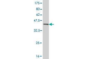 Western Blot detection against Immunogen (36. (AKR1C2 antibody  (AA 224-323))