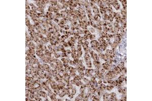 Immunohistochemical staining (Formalin-fixed paraffin-embedded sections) of human liver with ARSB polyclonal antibody  shows strong cytoplasmic positivity in hepatocytes.