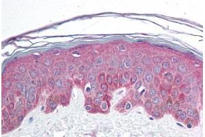 Human Skin (formalin-fixed, paraffin-embedded) stained with BRD7 antibody ABIN214730 at 10 ug/ml followed by biotinylated goat anti-rabbit IgG secondary antibody ABIN481713, alkaline phosphatase-streptavidin and chromogen. (BRD7 antibody  (C-Term))