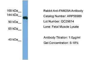 WB Suggested Anti-FAM29A  Antibody Titration: 0. (FAM29A antibody  (Middle Region))