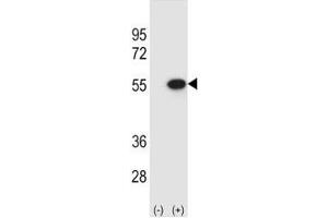 Western blot analysis of Reptin antibody and 293 cell lysate (2 ug/lane) either nontransfected (Lane 1) or transiently transfected (2) with the RUVBL2 gene. (RUVBL2 antibody  (AA 400-430))