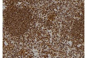 ABIN6269102 at 1/100 staining Mouse spleen tissue by IHC-P. (Progesterone Receptor antibody)