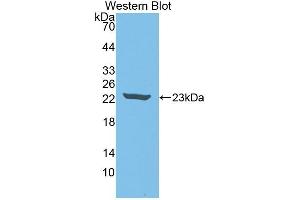 Detection of Recombinant IL18, Rabbit using Polyclonal Antibody to Interleukin 18 (IL18) (IL-18 antibody  (AA 32-192))