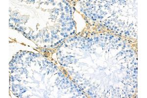 ABIN6257652 and ABIN6275247 at 1/100 staining Rat testis tissue by IHC-P.