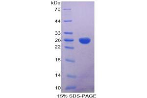 SDS-PAGE of Protein Standard from the Kit (Highly purified E. (Aconitase 1 ELISA Kit)