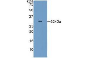 Detection of Recombinant CA4, Human using Polyclonal Antibody to Carbonic Anhydrase IV (CA4) (CA4 antibody  (AA 19-283))