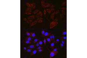 Immunofluorescence analysis of  cells using PMEL Rabbit pAb (ABIN7269510) at dilution of 1:100 (40x lens). (Melanoma gp100 antibody  (AA 25-300))