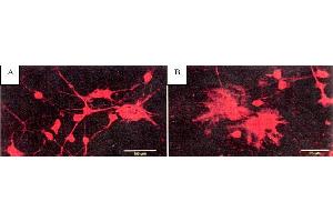anti-BAPTA antibody