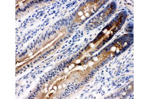 Anti-DDX4/MVH antibody, IHC(F) IHC(F): Rat Intestine Tissue (DDX4 antibody  (Middle Region))