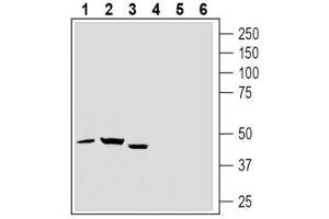 Western blot analysis of rat spleen lysate (lanes 1 and 4), rat brain lysate (lanes 2 and 5) and mouse brain lysate (lanes 3 and 6): - 1-3. (TBXA2R antibody  (Extracellular, N-Term))