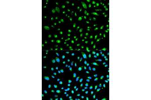 Immunofluorescence analysis of HeLa cell using WT1 antibody. (WT1 antibody  (AA 1-302))