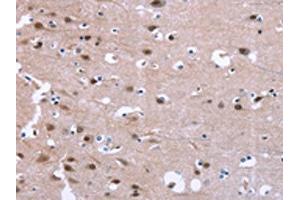 The image on the left is immunohistochemistry of paraffin-embedded Human brain tissue using ABIN7190847(GPR171 Antibody) at dilution 1/25, on the right is treated with synthetic peptide.