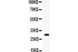 Western Blotting (WB) image for anti-CD8a Molecule (CD8A) (AA 22-187) antibody (ABIN3043499)