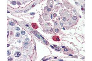 Immunohistochemistry (IHC) image for anti-Fc epsilon Receptor 1 antibody (ABIN2469910) (Fc epsilon Receptor 1 antibody)