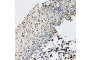 Immunohistochemistry of paraffin-embedded human esophagus using GBF1 antibody (ABIN5974908) at dilution of 1/100 (40x lens). (GBF1 antibody)