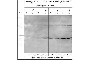 Western blot on brain lysates using Rabbit antibody to pro BDNF (50-90): . (Pro BDNF antibody)