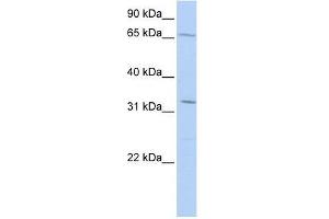 TRIM22 antibody used at 0. (TRIM22 antibody  (Middle Region))