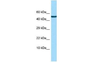 WB Suggested Anti-CHRDL2 Antibody Titration: 1. (CHRDL2 antibody  (N-Term))