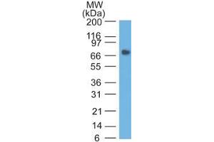 Western Blot analysis of human Stomach lysate using CEA Mouse Monoclonal Antibody (COL-1). (CEACAM5 antibody)