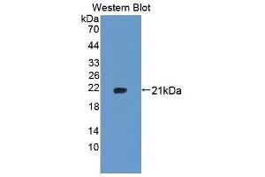 Figure. (UXT antibody  (AA 15-157))
