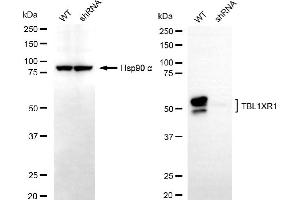 Western blotting analysis using TBL1XR1 antibody (ABIN7800597).