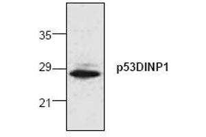 Image no. 1 for anti-Tumor Protein P53 Inducible Nuclear Protein 1 (TP53INP1) (N-Term) antibody (ABIN155075) (TP53INP1 antibody  (N-Term))