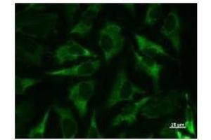 Immunostaining analysis in HeLa cells. (Mars (MARS) antibody)