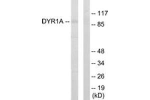 Western blot analysis of extracts from HepG2 cells, using DYR1A Antibody. (DYRK1A antibody  (AA 21-70))