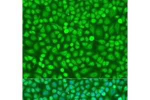 Immunofluorescence analysis of U2OS cells using HOXB5 Polyclonal Antibody at dilution of 1:100. (HOXB5 antibody)