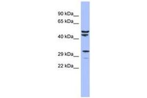 Image no. 1 for anti-Mitochondrial Ribosomal Protein S15 (MRPS15) (AA 35-84) antibody (ABIN6742891) (MRPS15 antibody  (AA 35-84))