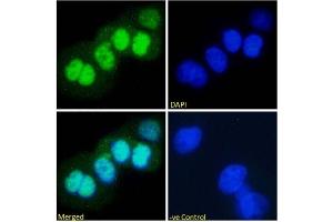 Immunofluorescence staining of fixed A431 with anti-p53 antibody PAb421. (Recombinant p53 antibody  (AA 371-380))